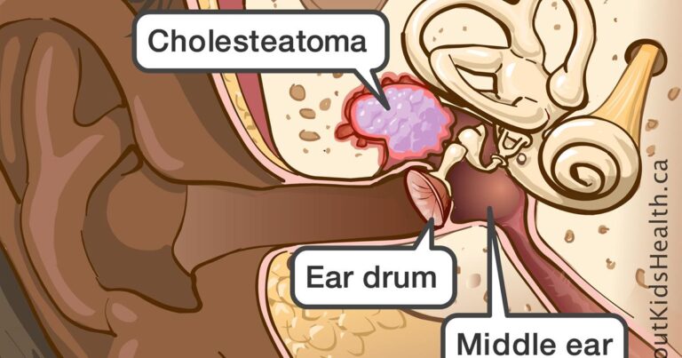 ear-mastoidectomy-dr-meenesh-juvekar-ent-specialist