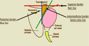 ear - MACEWEN’S TRIANGLE - Dr. Meenesh Juvekar - ENT Specialist