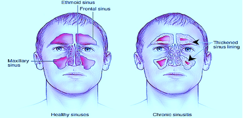 ENT Specialist Doctor In Mumbai Screenshot 2020 11 27 Ganpati nose