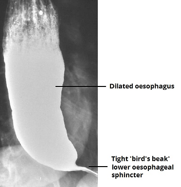 Specialist ENT Screenshot 2020 11 30 book oesophagus almost final5