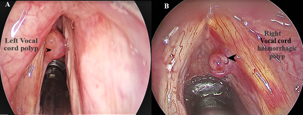 ENT Specialist Doctor In Mumbai Screenshot 2020 12 01 larynx 2020 new bs almost final edted 8 9 2020 2