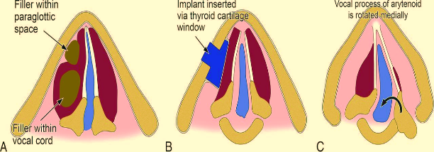 Specialist ENT Screenshot 2020 12 01 larynx 2020 new bs almost final edted 8 9 2020 2