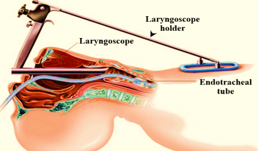 ENT Specialist Doctor In Mumbai Screenshot 2020 12 01 larynx 2020 new bs almost final edted 8 9 2020 2 docx5 1