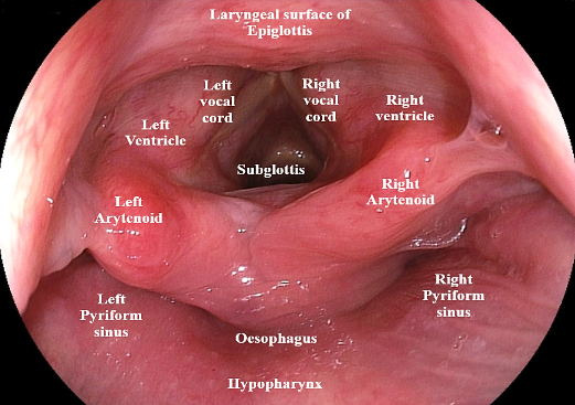 Specialist ENT Screenshot 2020 12 01 larynx 2020 new bs almost final edted 8 9 2020 2 docx6 1