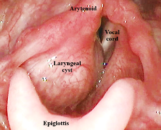 ENT Specialist Doctor In Mumbai Screenshot 2020 12 01 larynx 2020 new bs almost final edted 8 9 2020 2