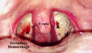 Specialist ENT Screenshot 2020 12 02 ORAL CAVITY AND PHARYNX SEMIFINAL BS docx10