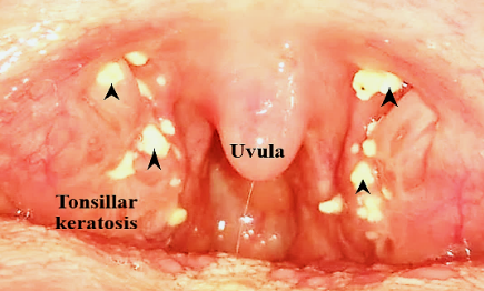 Oral cavity