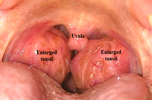 Specialist ENT Screenshot 2020 12 02 ORAL CAVITY AND PHARYNX SEMIFINAL BS