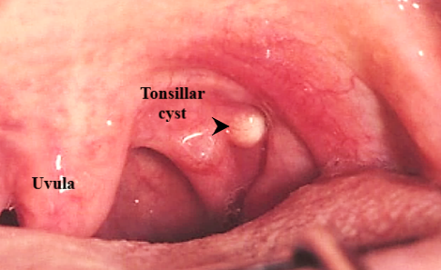 Specialist ENT Screenshot 2020 12 02 ORAL CAVITY AND PHARYNX SEMIFINAL BS