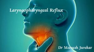 Reflux pharyngitis